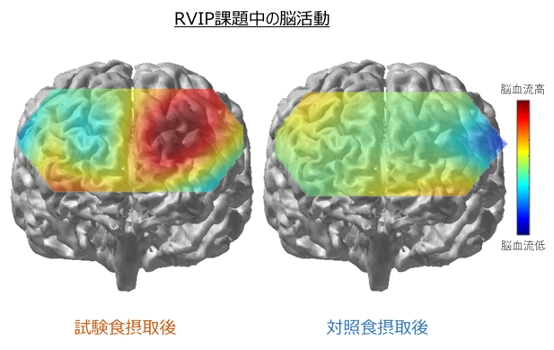 RVIP課題中の脳活動